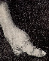 Связанная нога