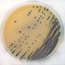 MRSA swabbed from CAFO workers' noses was also found on the walls and in animals at the facility where they worked. MRSA on Brilliance MRSA Chromogenic Agar.jpg