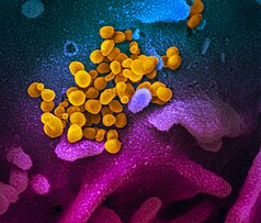 SARS-CoV-2 emerging from a human cell