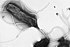 Helicobacter pylori w mikroskopie elektronowym