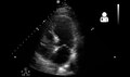 File:UOTW 36 - Ultrasound of the Week 1.webm