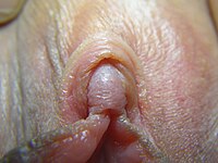 Human female glans clitoris