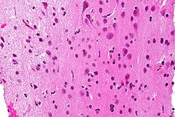 صورة مجهرية تظهر المادة الرمادية بأجسام خلاياها العصبونية (إلى يمين الصورة - الظل الغامق للون الوردي) والمادة البيضاء بمظهرها المميز الشبيه بالشبكة (إلى يسار الصورة - الظل الأفتح لللون الوردي) . صبغة HPS.