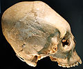 Aus dem 5. Jahrhundert n. Chr. gibt es zahlreiche Funde künstlich deformierter Schädel. Dieser Schädel wird einer Alamannin zugeschrieben (Landesmuseum Württemberg, Stuttgart)