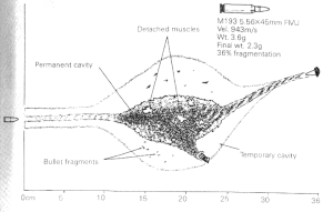 M16 5.56 × 45 мм баллистическая рана