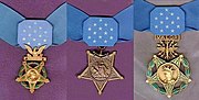 A(z) Medal of Honor lap bélyegképe