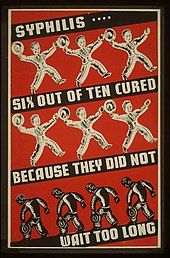 Depression-era U.S. poster advocating early syphilis treatment. Although treatments were available, participants in the study did not receive them. Syphilis-poster-wpa-cure.jpg