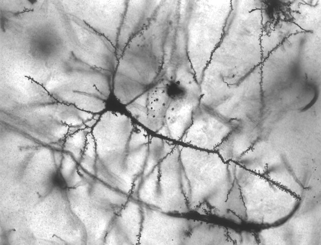 Image of neurons