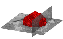 A volumetric surface render (red) of the nuclear envelope of one HeLa cell. The cell was observed in 300 slices of electron microscopy, the nuclear envelope was automatically segmented and rendered. One vertical and one horizontal slice are added for reference. Nuclear envelope of one cancerous HeLa cell.png