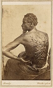 Medical examination photo of Gordon showing his scourged back, widely distributed by Abolitionists to expose the brutality of slavery. From at least the 1860s onwards, photography was a powerful tool in the abolitionist movement. Gordon, scourged back, NPG, 1863.jpg