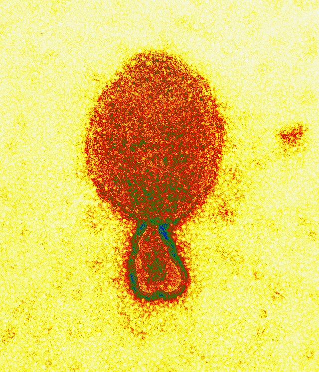 False-coloured electron micrograph of Hendra virus