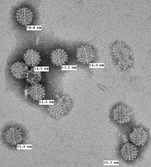 Electron microphotograph (x50,000) of MCV capsids artificially produced as virus-like particles by expressing MCV structural proteins in cells. The 55-60 nm viral capsids have typical icosahedral symmetry found in polyomaviruses. MCV VLP EM PTA staining.jpg