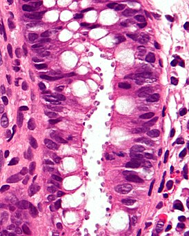 Cryptosporidiosis - very high mag - cropped.jpg