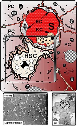 Hepatic stellate cell (ito cell) 1476-5926-6-7-3-l.jpg