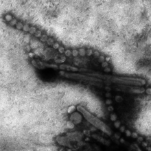 Electron micrograph of Influenza A H7N9.png