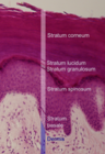 Die oberen Hautschichten (verhorntes Plattenepithel) als mikroskopisch (histologisches) Präparat