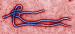 Ebola-Virus (nachträglich koloriert)