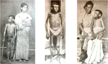 Victims of the reconcentration policy of Valeriano Weyler in Cuba, 1898. Weyler reconcentrados.png