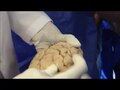 Файл: Демонстрация полушария головного мозга - Санджой Саньял - Лаборатория неврологии, осень 2013 г. (обрезано с 4 мин. 51 сек. До 5 мин. 20 сек.) - Precentral sulcus.webm