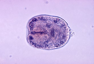 Echinococcus granulosus scolex.jpg