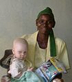 Albino child with mother in Kenya - too blurry and grainy - non-illustrative - image needs renaming - can't use this caption (no source)