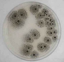 Aspergillus awamori.jpg