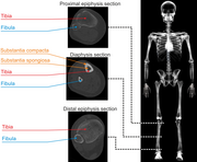 Computed tomography, Tibia, Modulus of Elasticity, anatomy