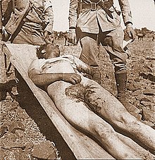 An Italian soldier who was castrated and emasculated during the Second Italo-Ethiopian War. Italian military emasculated Second Italo-Ethiopian War.jpg