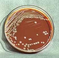 Gram-negative Yersinia pestis bacteria. The culture was grown over a 72-hour time period. Yersinia pestis HHS.jpg