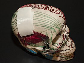 Пластина для черепа с трехмерной печатью (5255) (18492487005) .jpg