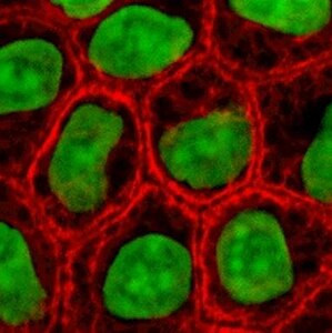 Células de la piel vistas al microscopio