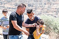 Child hurt from tear gas during protest against Evyatar outpost, July 2021
