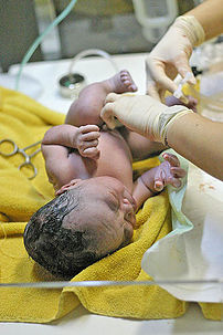 A newborn baby with umbilical cord ready to be clamped