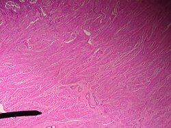 Uterus (myometrium).JPG