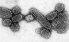 http://upload.wikimedia.org/wikipedia/commons/thumb/e/ee/Reconstructed_Spanish_Flu_Virus.jpg/220px-Reconstructed_Spanish_Flu_Virus.jpg