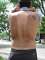 Γραμμές μαυρίσματος στην πλάτη ενός άνδρα, ύστερα από έκθεση στον ήλιο με αμάνικη φανέλα