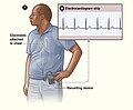 Elektrody během monitorování nejsou nijak zvlášť viditelné, neboť je lze poměrně dobře schovat pod oděv.