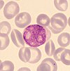 Myeloblast