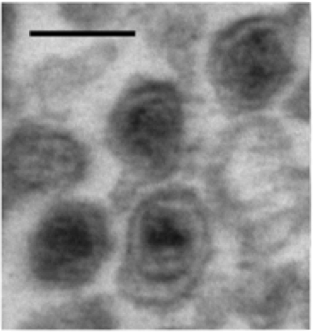 Fájl:Electron micrograph of microvesicles.tiff