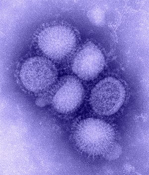 Вирус гриппа H1N1.jpg