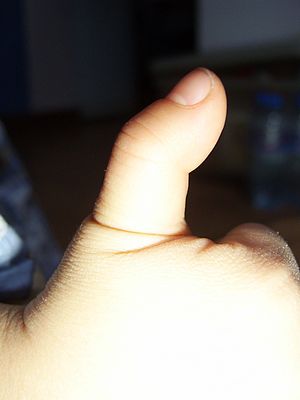 Thumb image