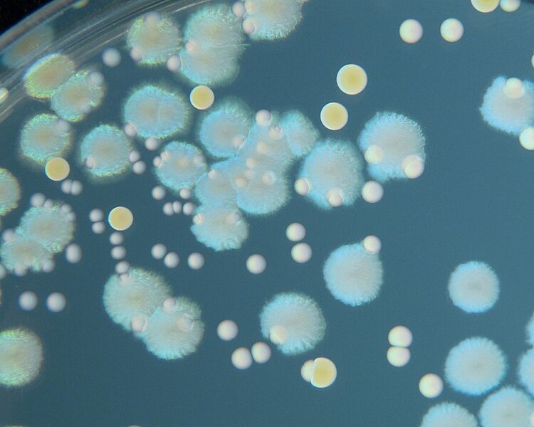 File:Bacteria on agar plate.jpg