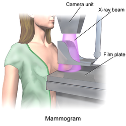 Mammography.