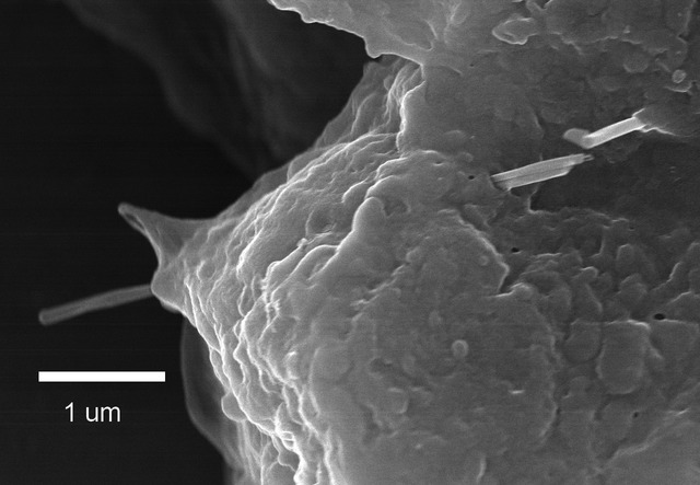 A greyscale microscope image showing a rigid rod extending from both sides of a mottled cellular mass