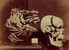 Lewis Carroll: Lebka a ploutve tresky a lidská lebka, 1857