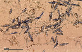Microsporum gypseum e a presença de macroconídios fusiformes.