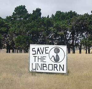 A sign promoting the saving of unborn children...