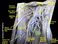 Deep artery of the thigh