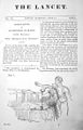 The Lancet: il numero del 13 giugno 1829. L'autore dell'articolo sulla trasfusione di sangue è James Blundell.
