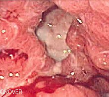 Duodenal Histology Wiki